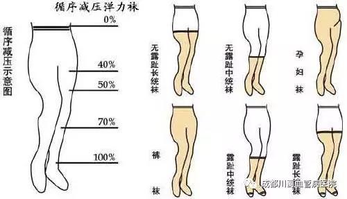 医用弹力袜,静脉曲张,成都川蜀血管病医院